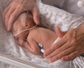 Newborn Intensive Care and NICUs